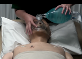 Laryngeal Mask Airway