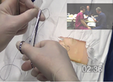 Suturing