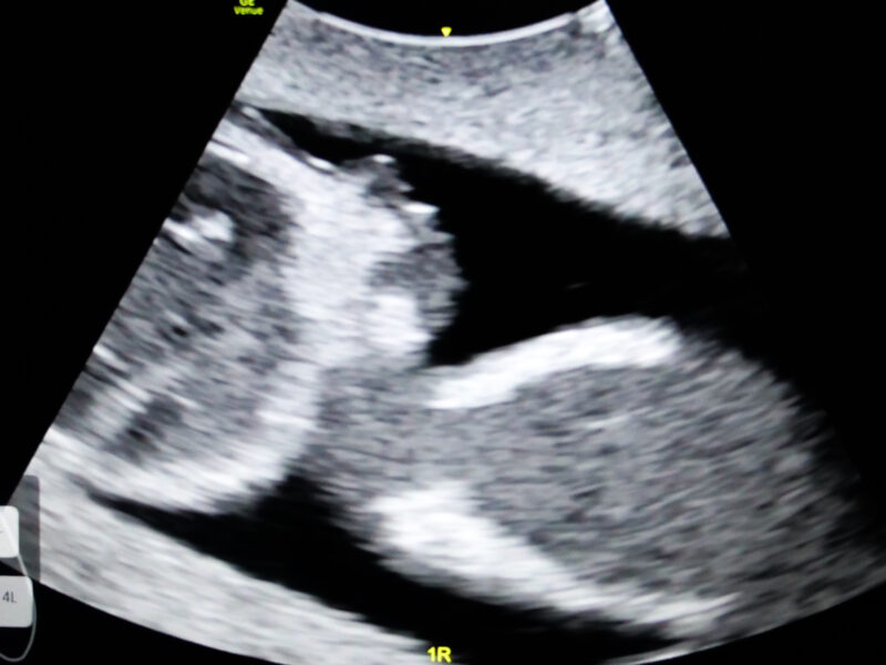 obstetrics-and-gynaecology-ultrasound obstetrics-and-gynaecology