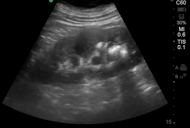Abdominal Paediatric Scanning Paediatric Ultrasound Course