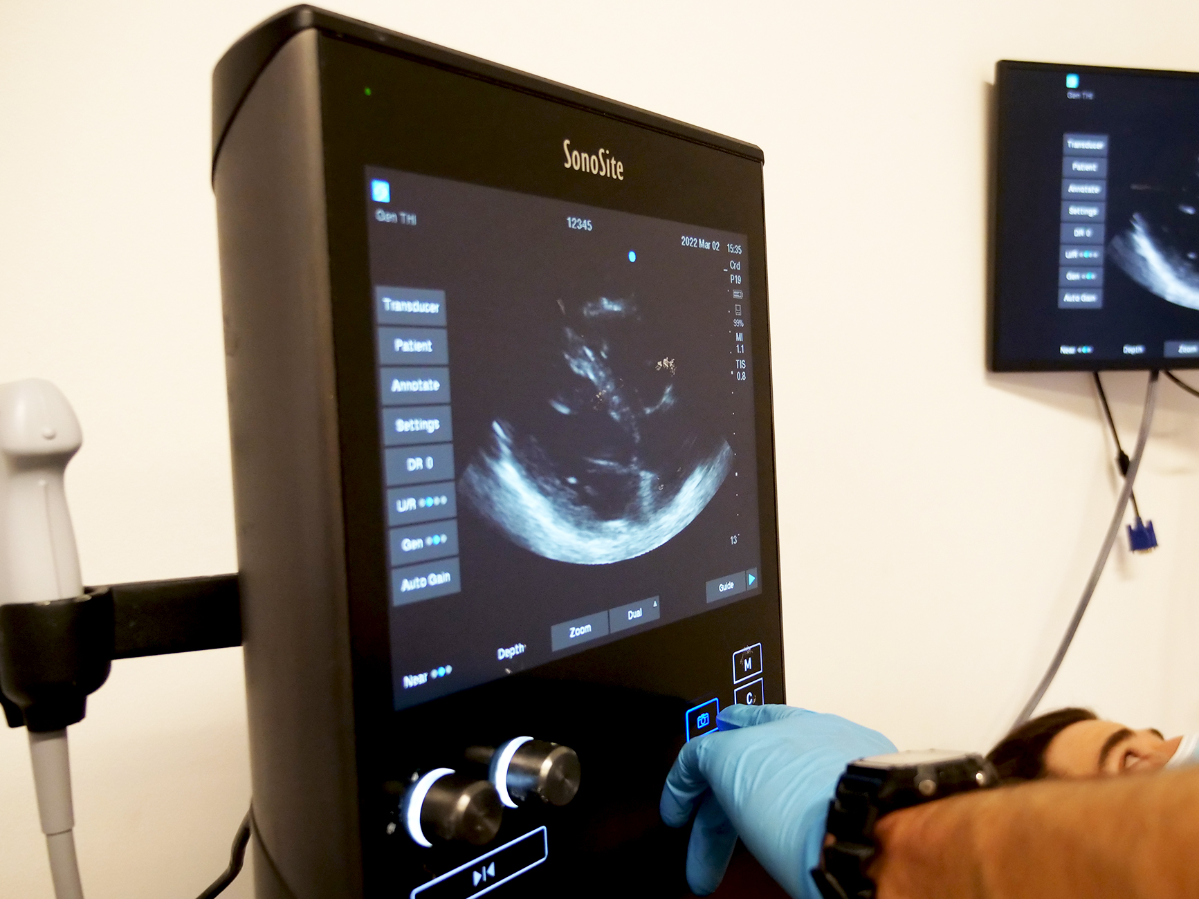 Abdominal Ultrasound Training