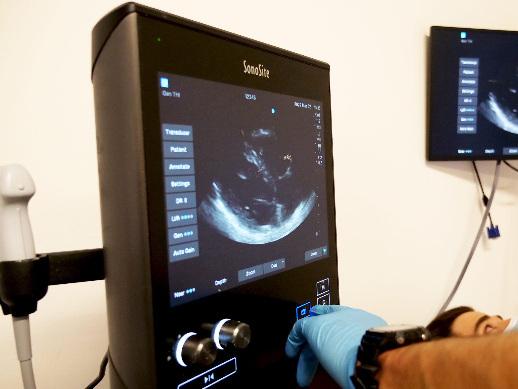 Abdominal US – 1 Abdominal Ultrasound Training