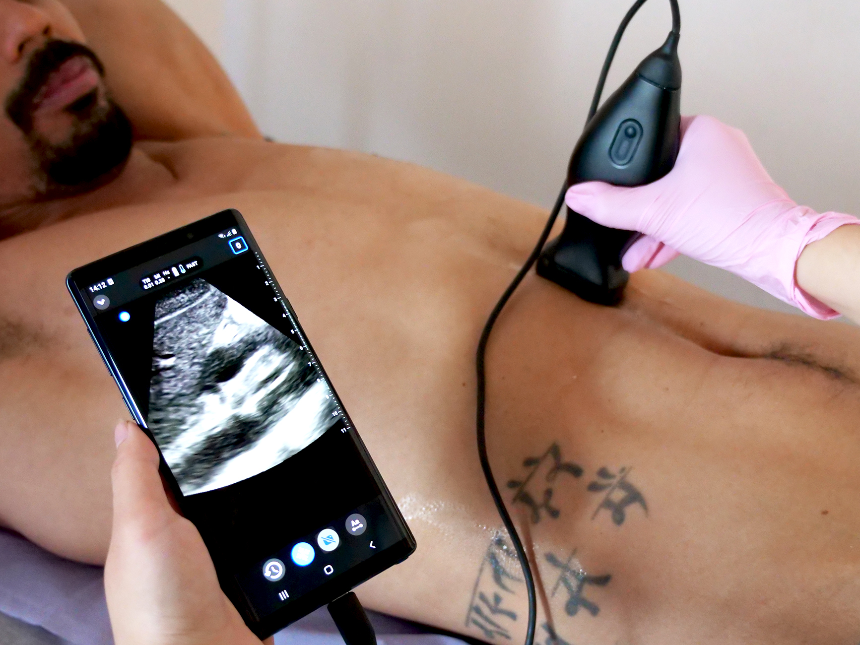Abdominal US – 3 Abdominal Ultrasound Course