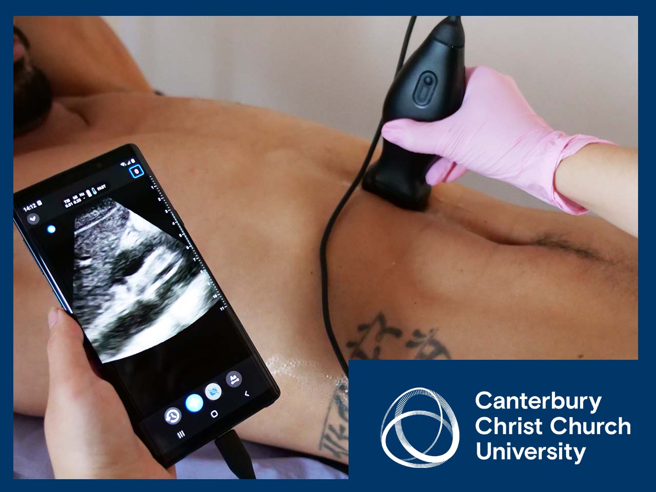 Abdominal PoCUS for Physicians