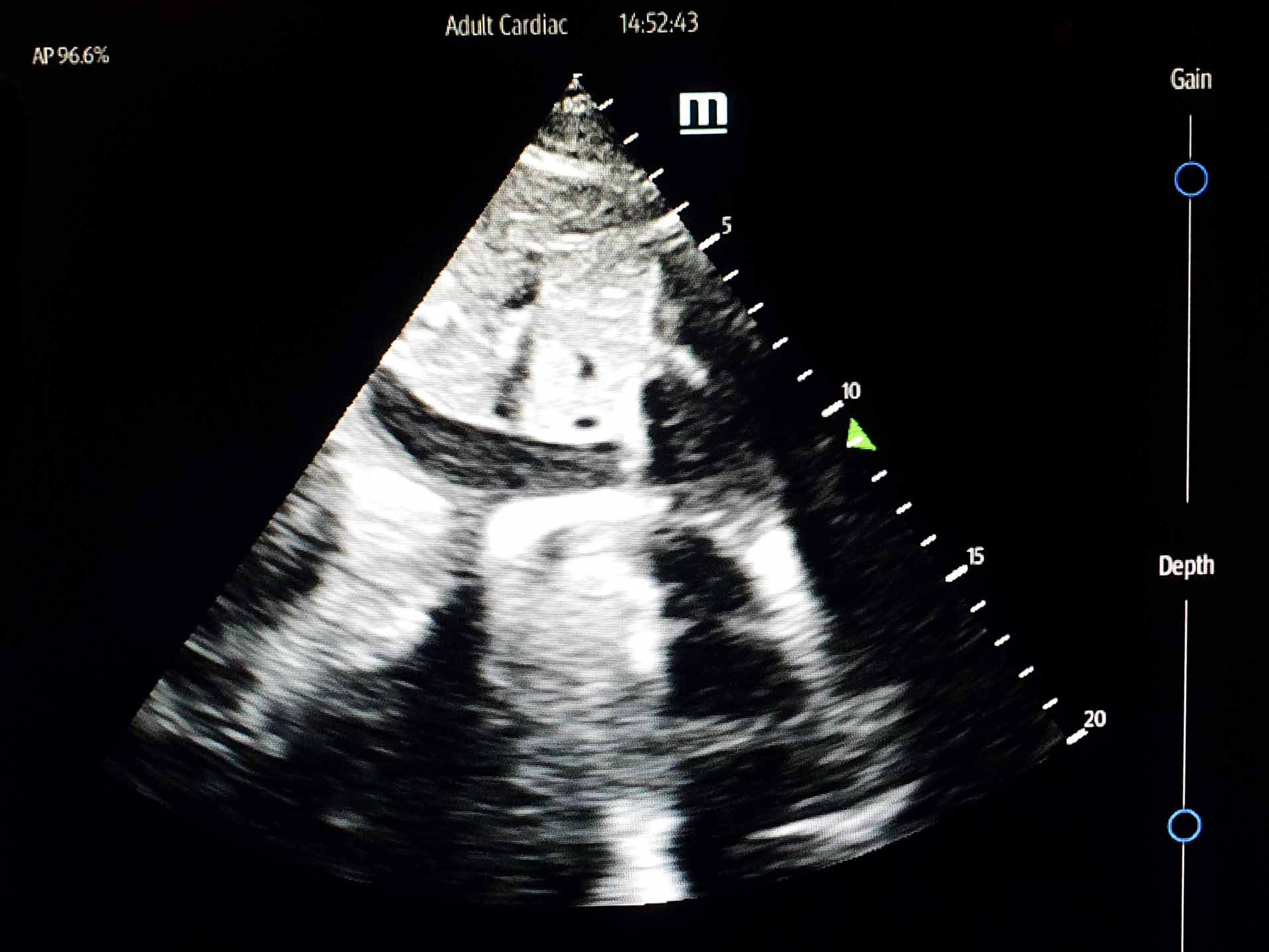 Adult-Cardiac-Micro-Credentials Adult-Cardiac-Micro-Credentials