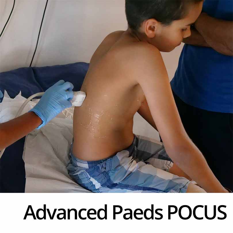 Advanced Paediatric PoCUS course