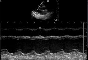 Cardiac scanning (LV M-mode)