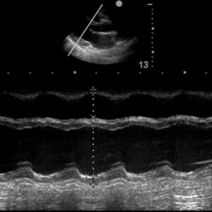 Cardiac scanning