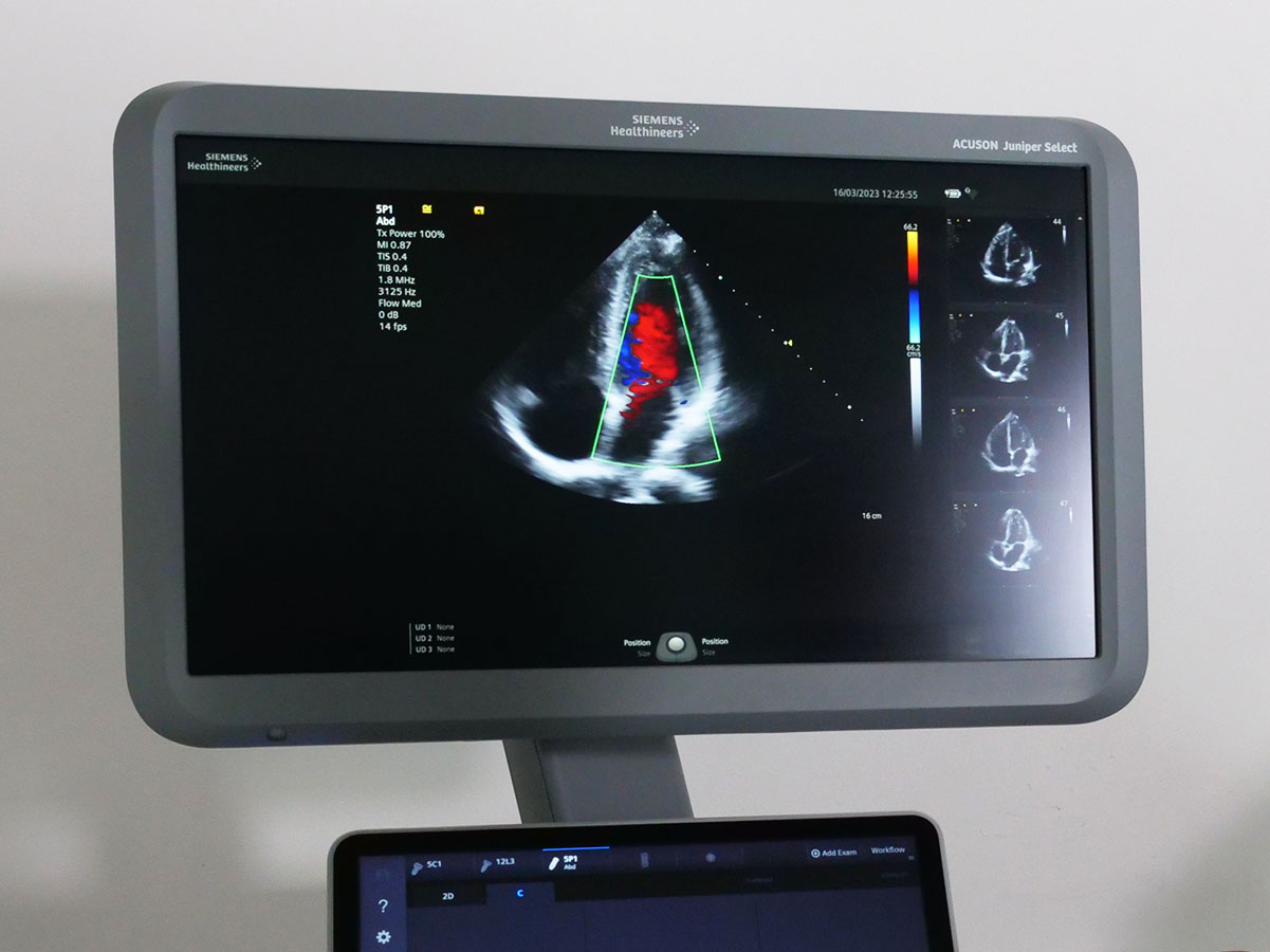 Cardiac ultrasound Cardiac ultrasound