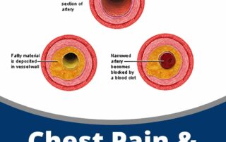 chest-pain-arrythmias