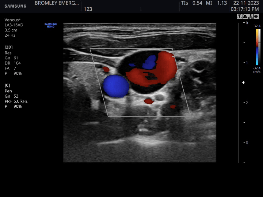 Colour doppler FUSIC Abdomen, Vascular & DVT Course