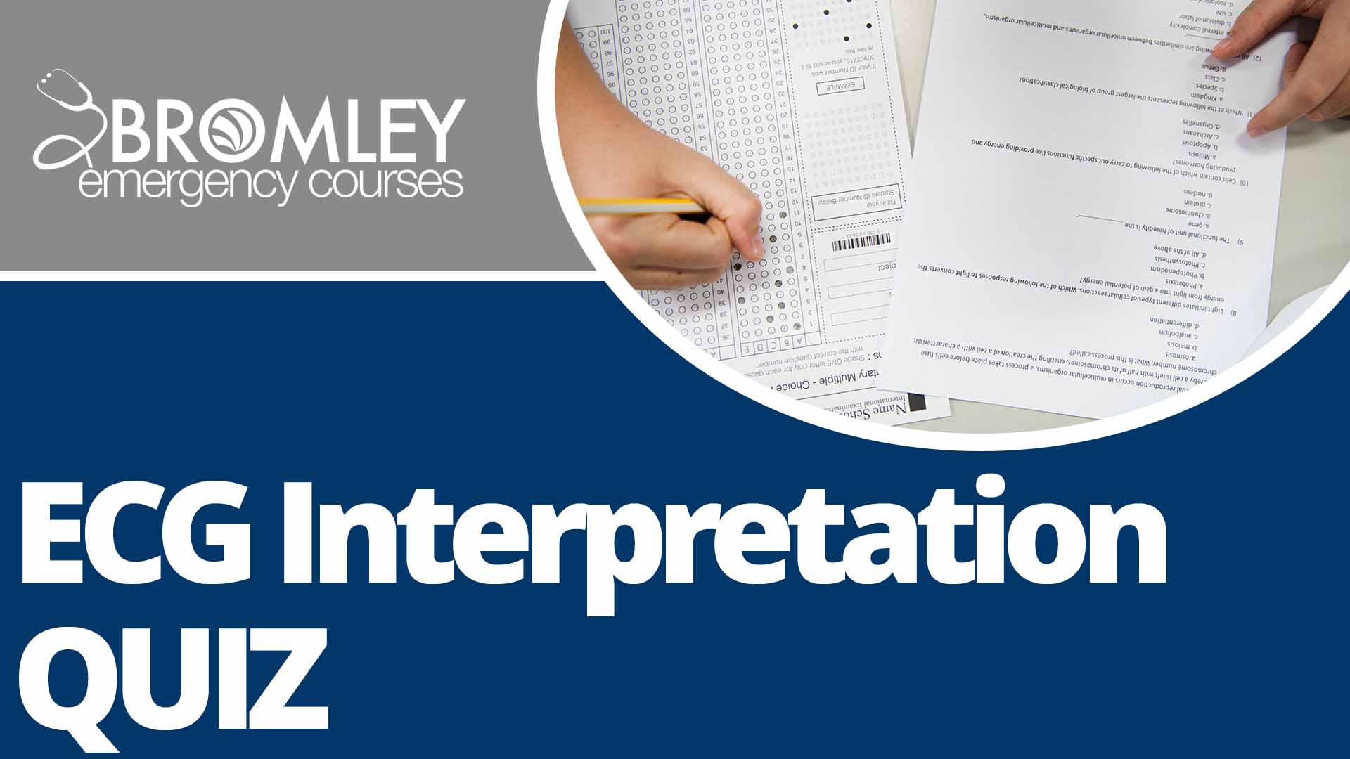 ECG Interpretation Quiz
