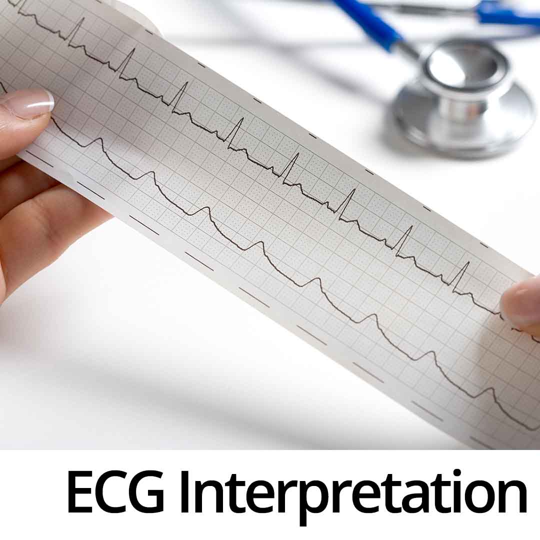 ECG Interpretation Course