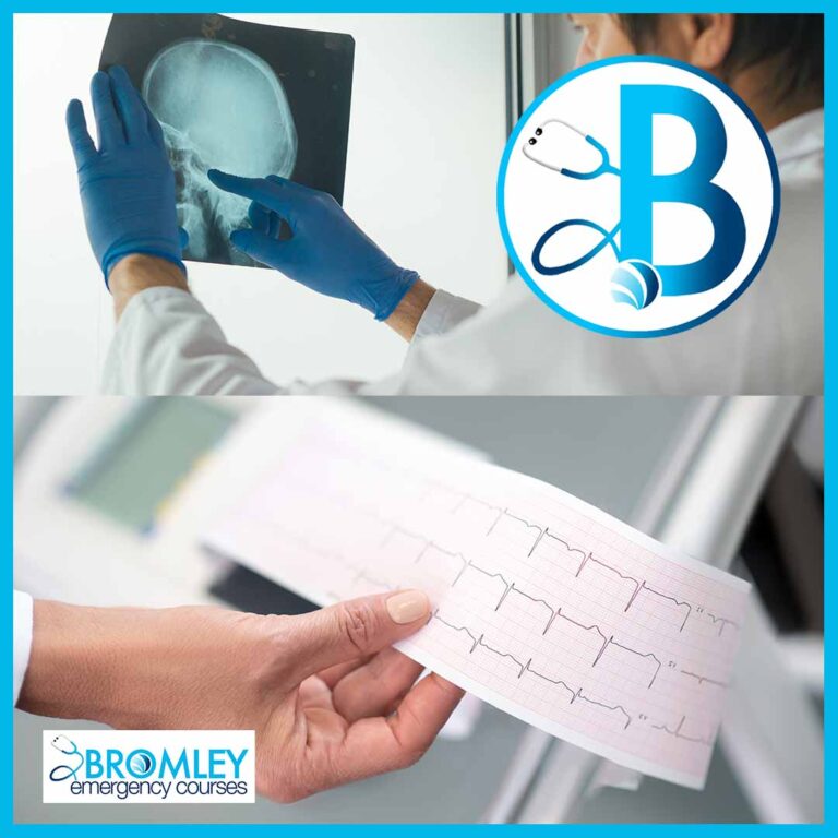 Book Both ECG and X-Ray Interpretation Courses and Save £50