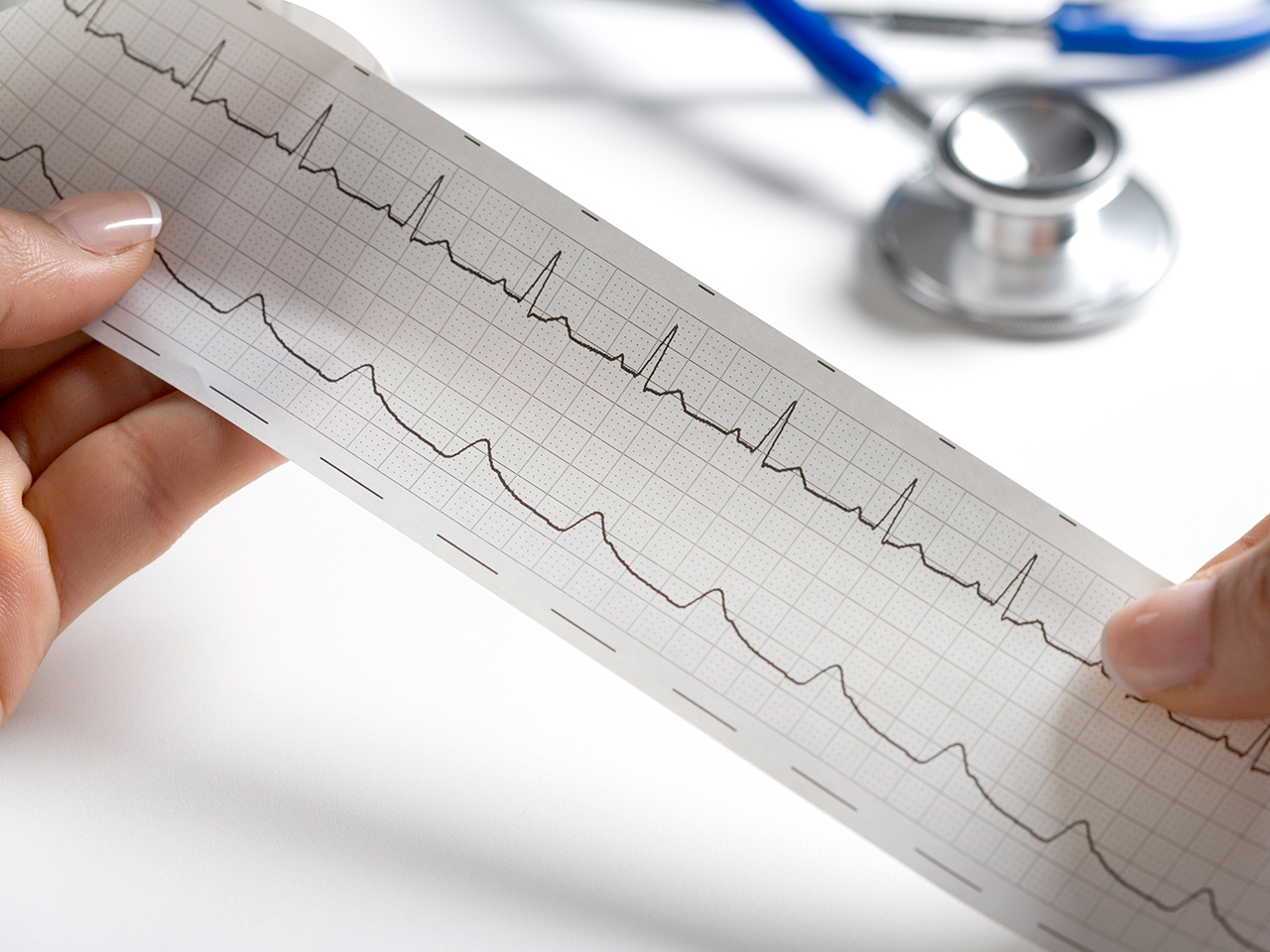 ECG reading