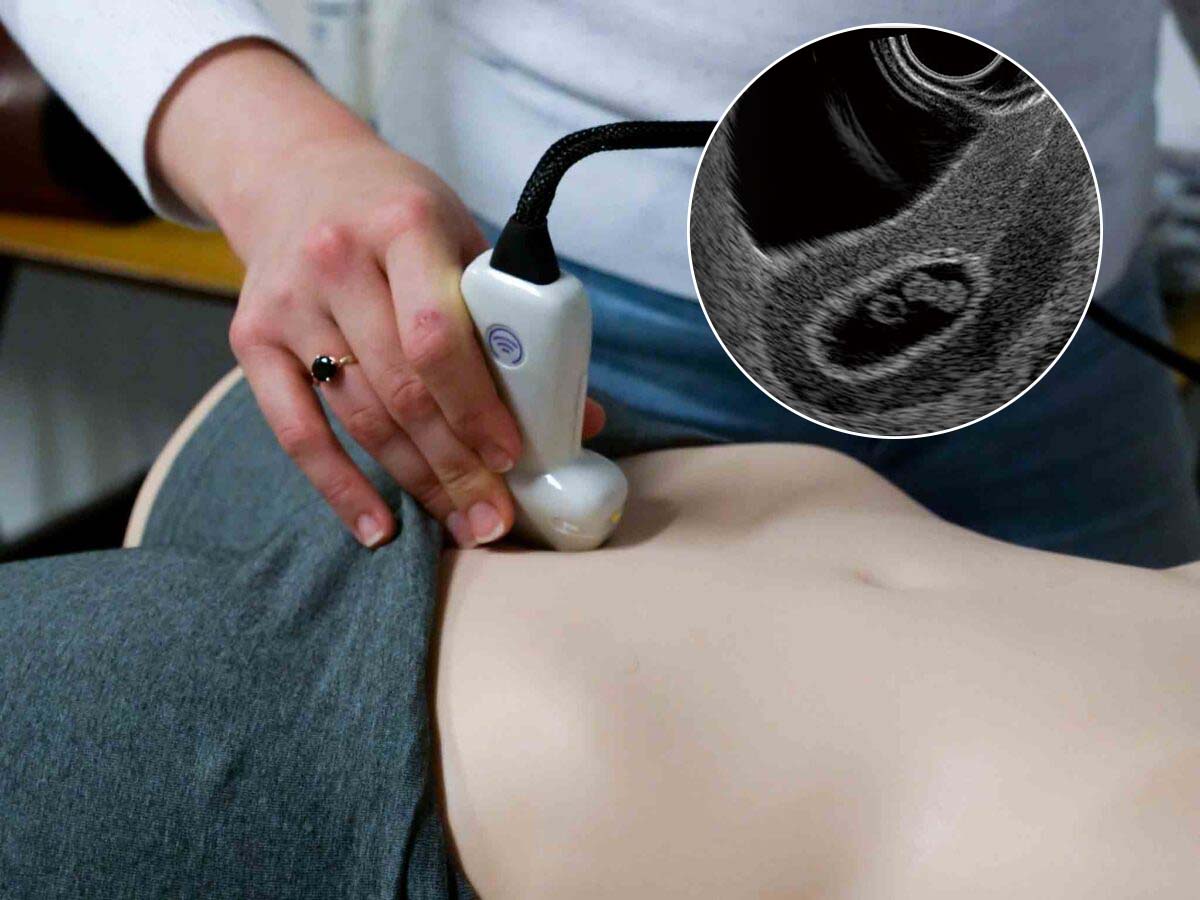 Eve ultrasound simulator with early pregnancy scan Ultrasound Training Simulator Featuring Early Pregnancy