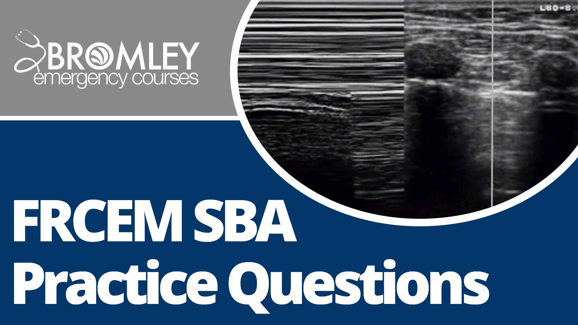 frcem-sba-questions