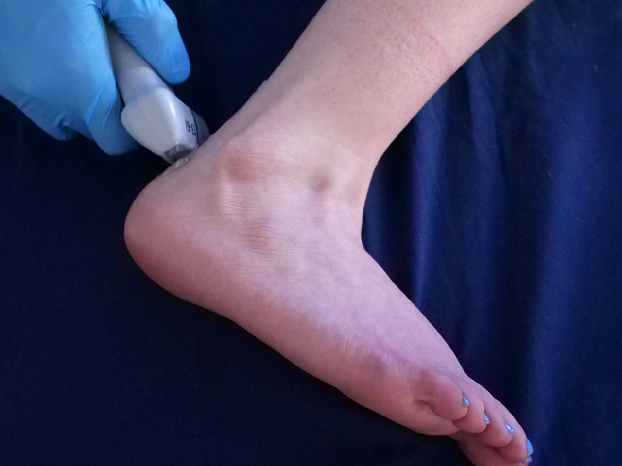 Foot and Ankle Ultrasound Course Foot and Ankle Ultrasound Course