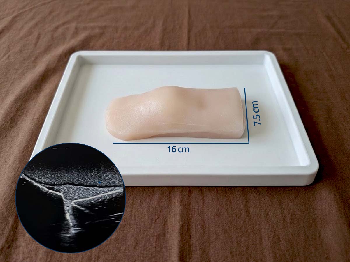 Colles’ Fracture Ultrasound Training Phantom