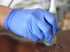 PoCUS for Haemodynamic assessmen
