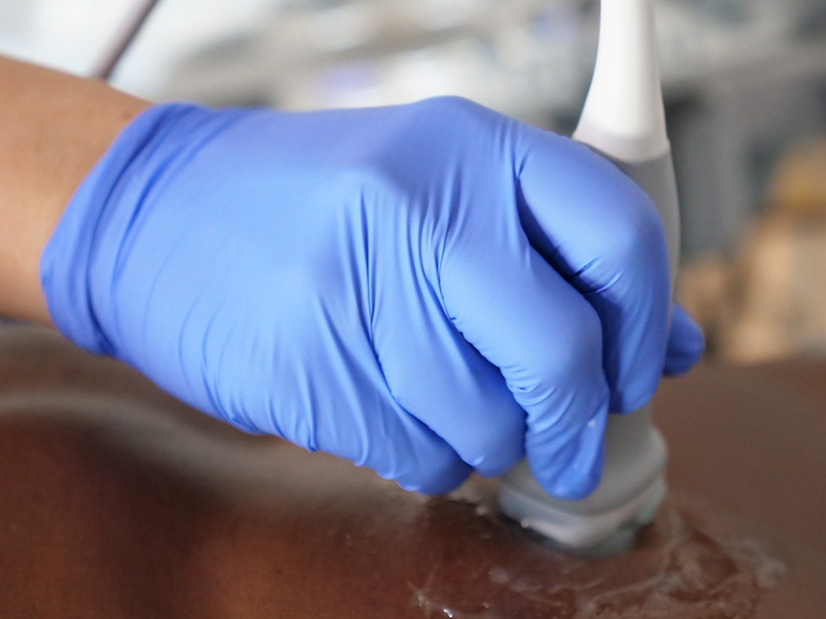 Haemodynamic assessment 1 PoCUS for Haemodynamic assessmen