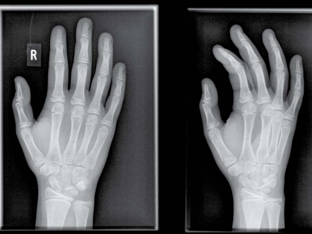 X-ray interpretation course