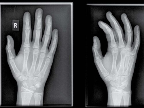 X-ray interpretation course