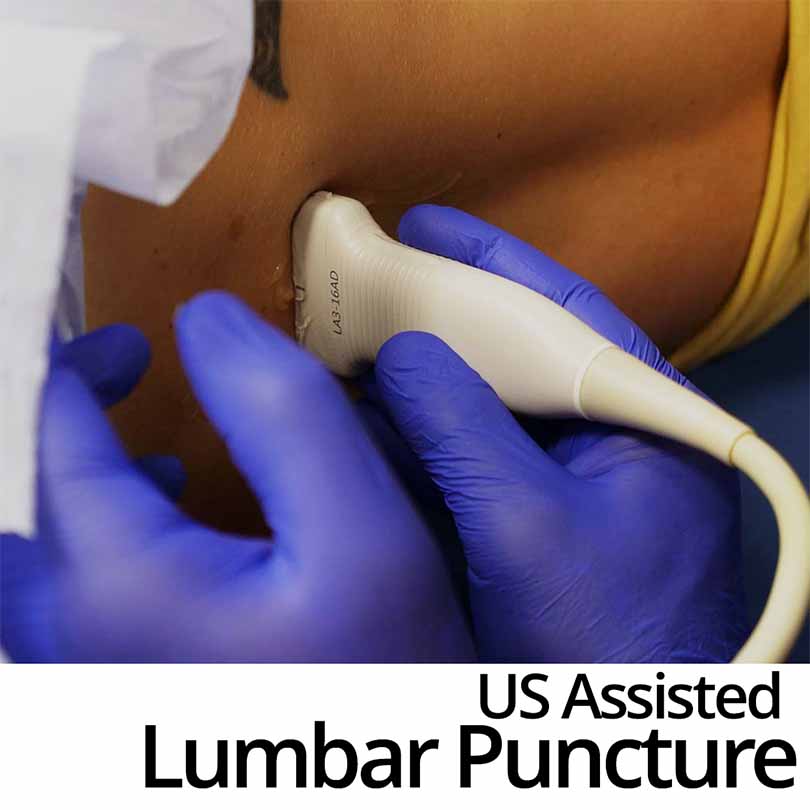 Ultrasound-Assisted Lumbar Puncture Course