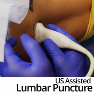 Ultrasound Assisted Lumbar Puncture