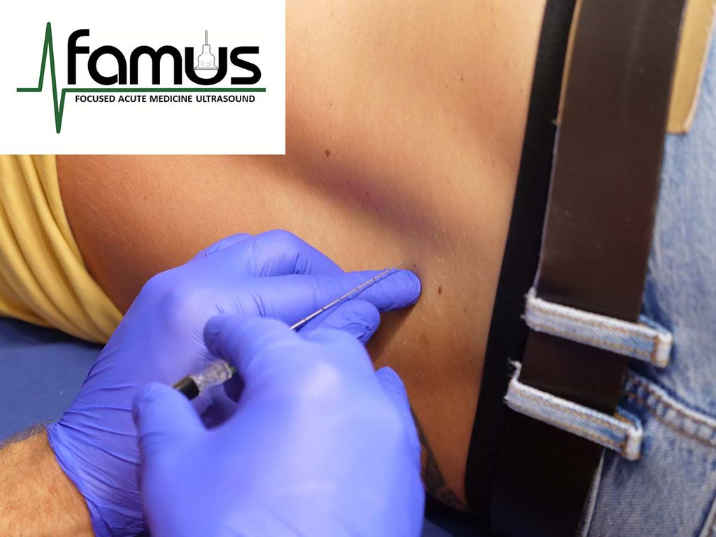 Ultrasound-Assisted Lumbar Puncture Course