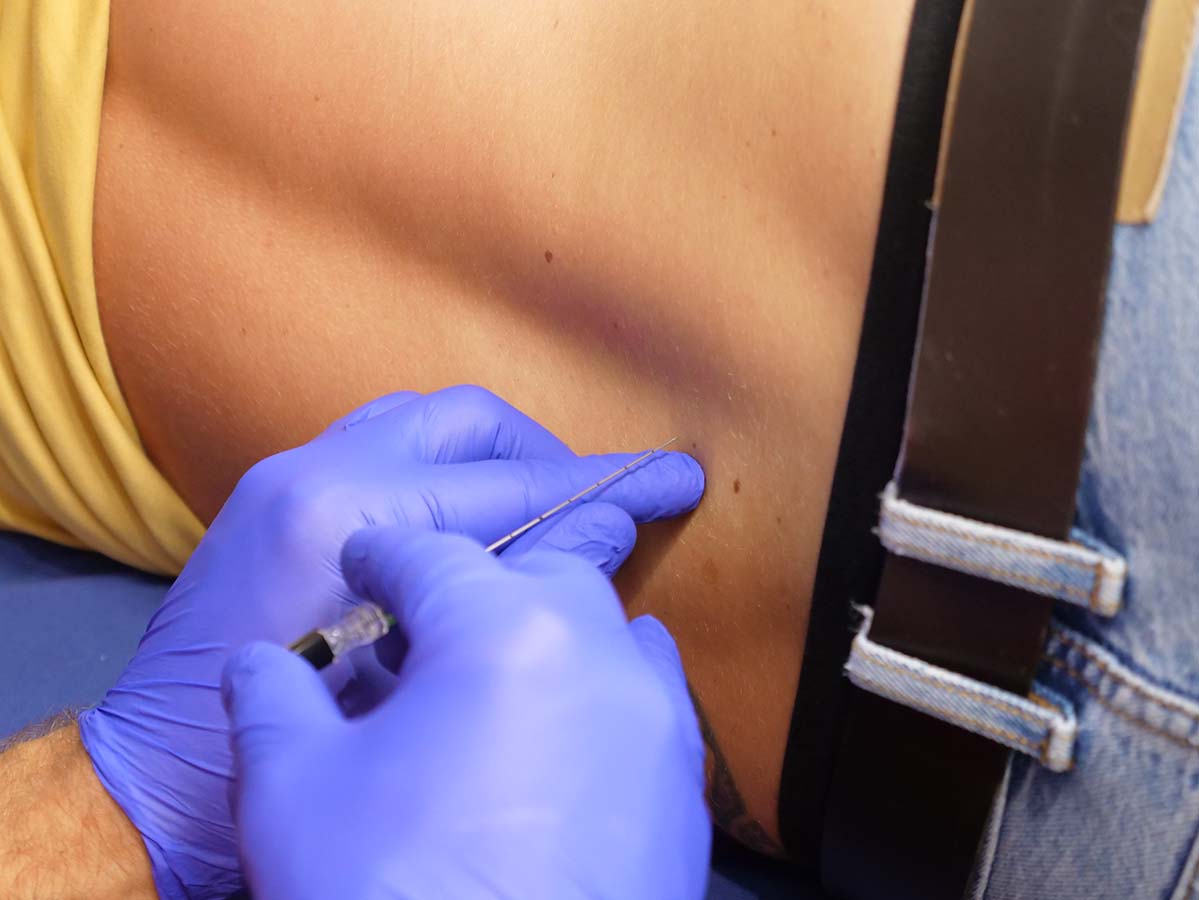 Lumbar Puncture