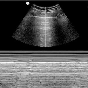 Lung M-mode normal