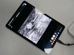 Nerve Block model - ultrasound view