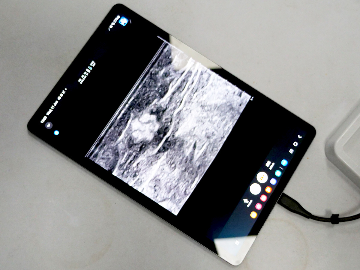 Nerve Block model – ultrasound view1 Ultrasound-Guided Nerve Block Training Phantom - ultrasound view