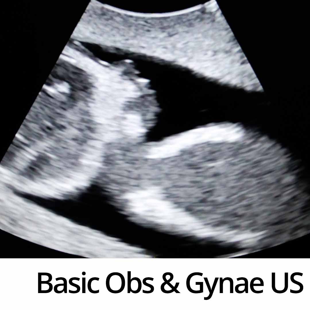 Basic Obs & Gynae Ultrasound Course