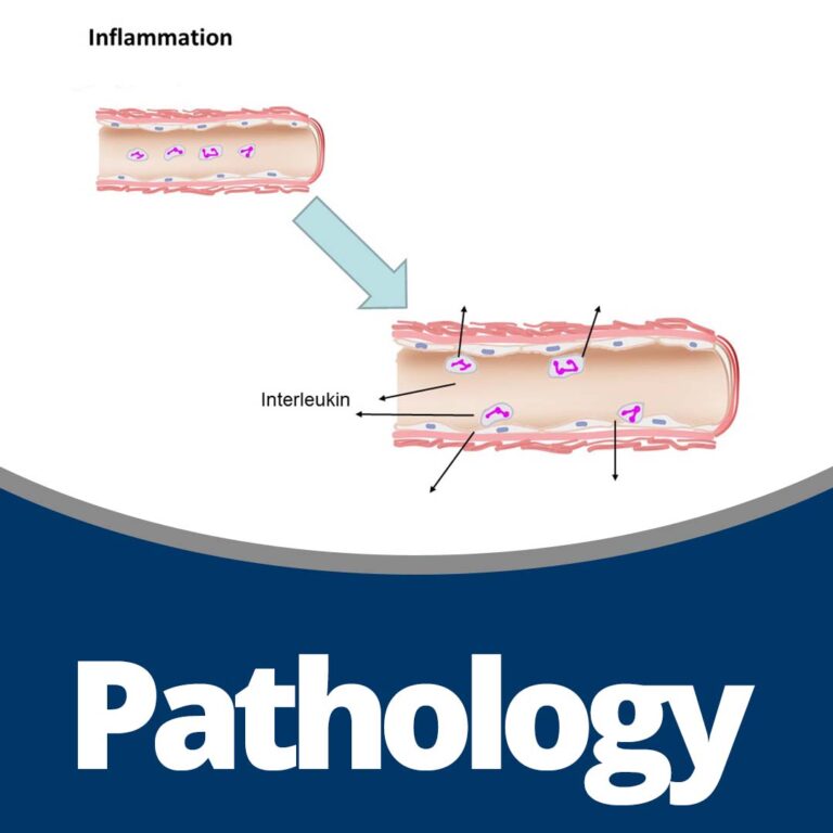 Pathology (33 min)