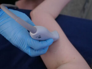 PoCUS for Skin Lumps