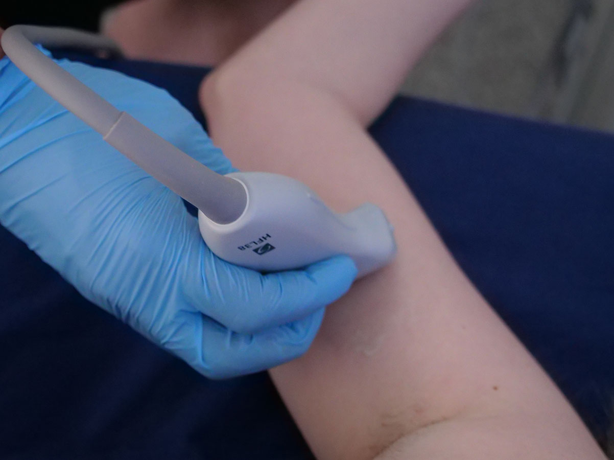 PoCUS for Skin Lumps