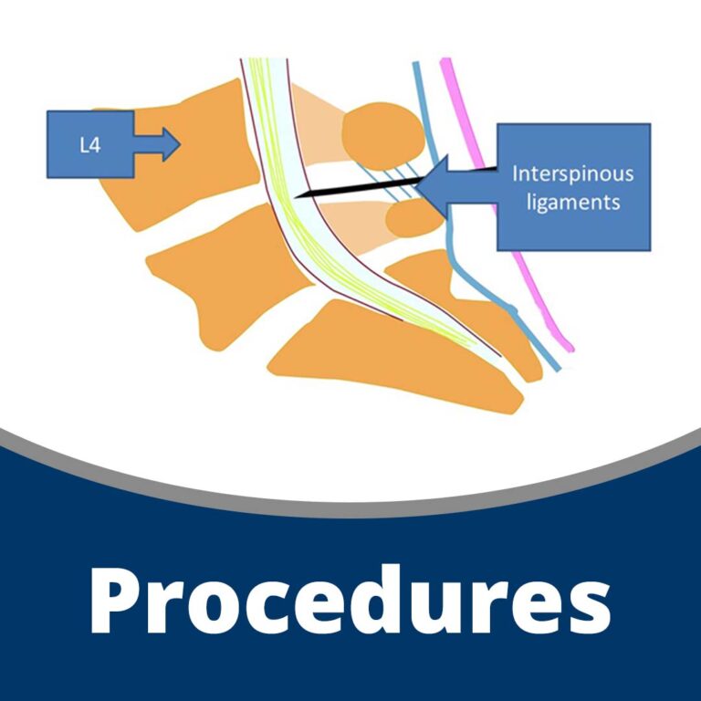 Procedures (84 min)