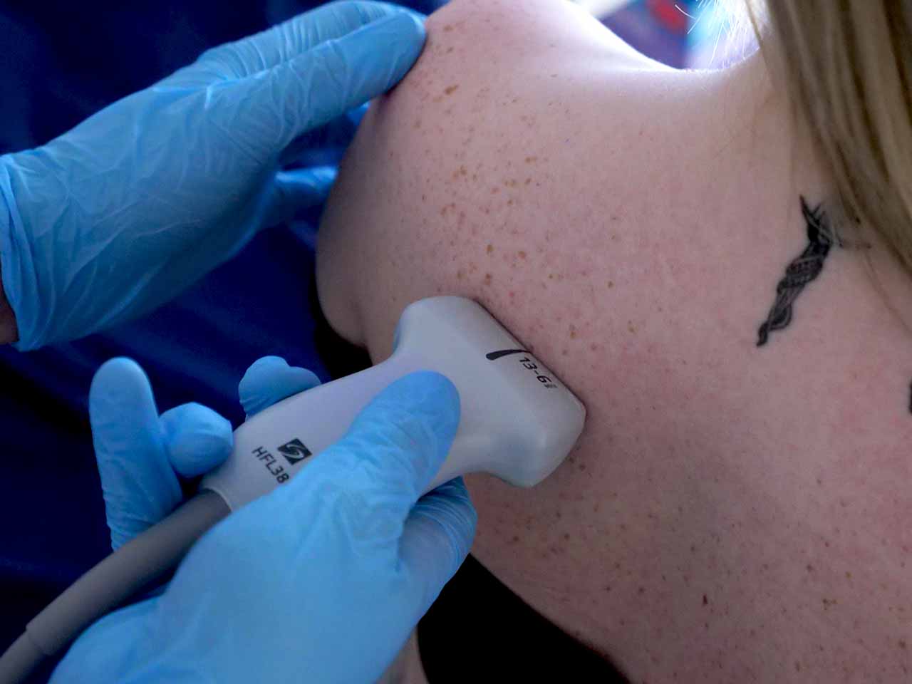 Shoulder Ultrasound Course Shoulder Ultrasound Course