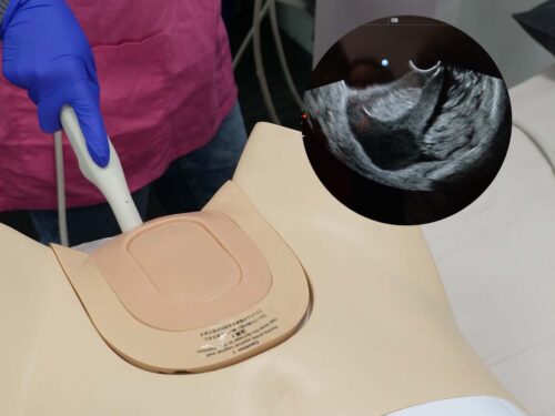 Transvaginal scanning
