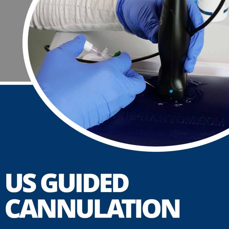 Ultrasound Guided Cannulation