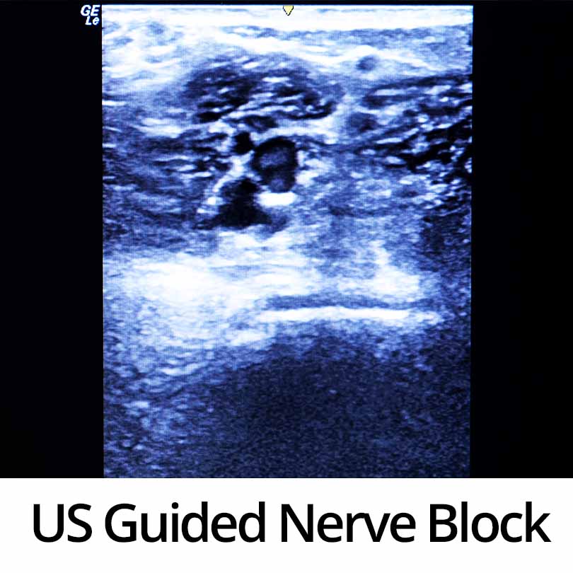 Ultrasound Guided Nerve Block Course