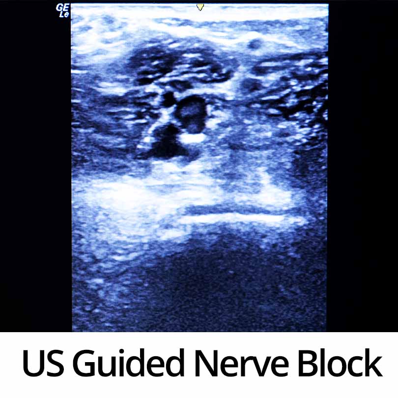 Ultrasound Guided Nerve Block course