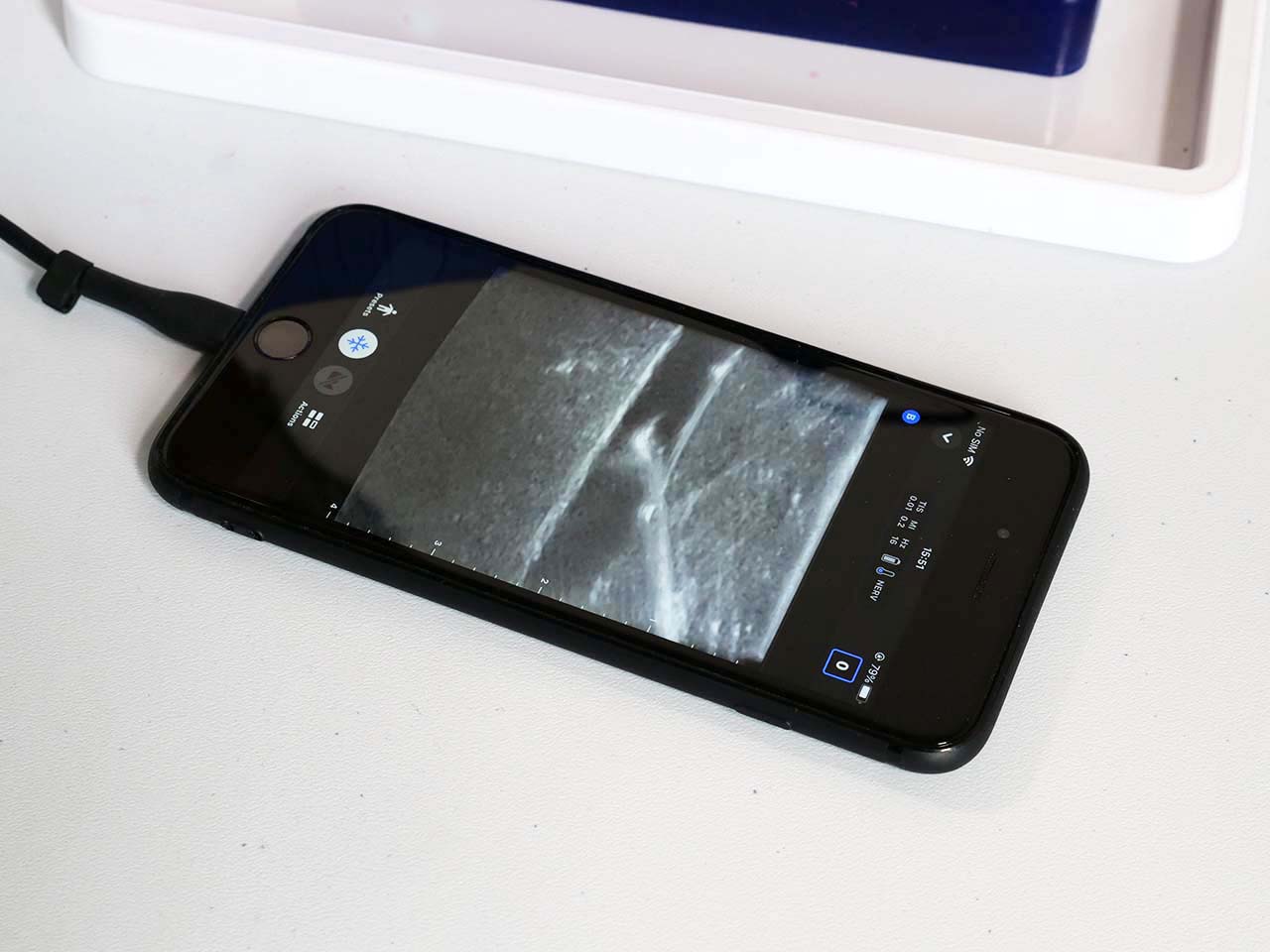 Ultrasound Guided Vascular Access Course UK Ultrasound Guided Vascular Access Course UK