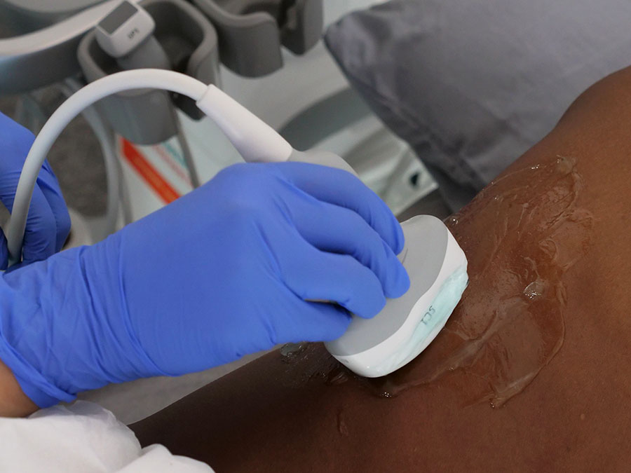 Ultrasound Guided Nerve Block 1200×900