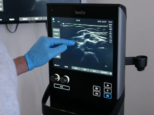 Ultrasound Guided Regional Anaesthesia