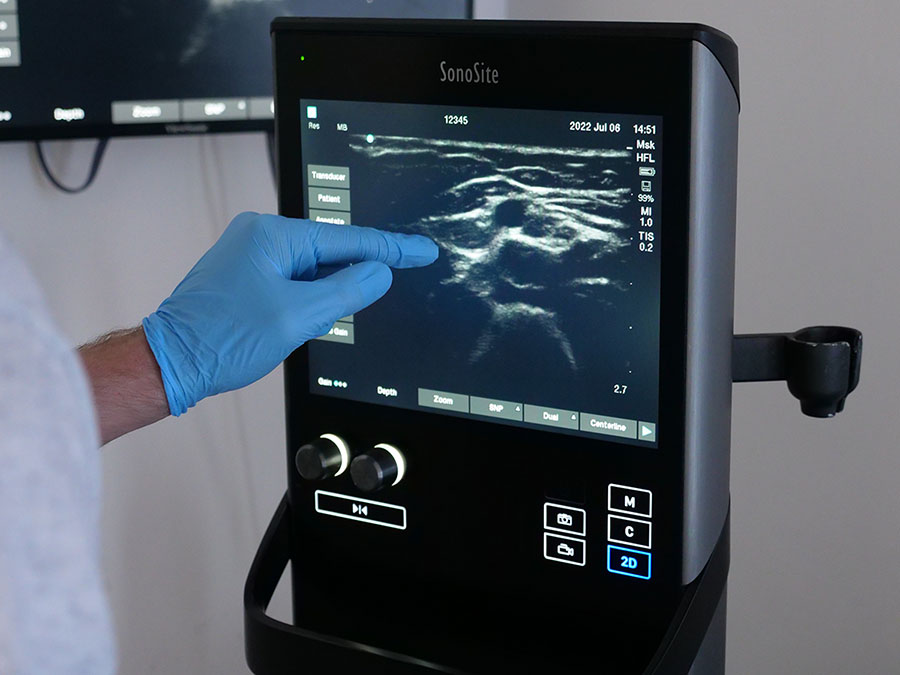 Ultrasound Guided Regional Anaesthesia