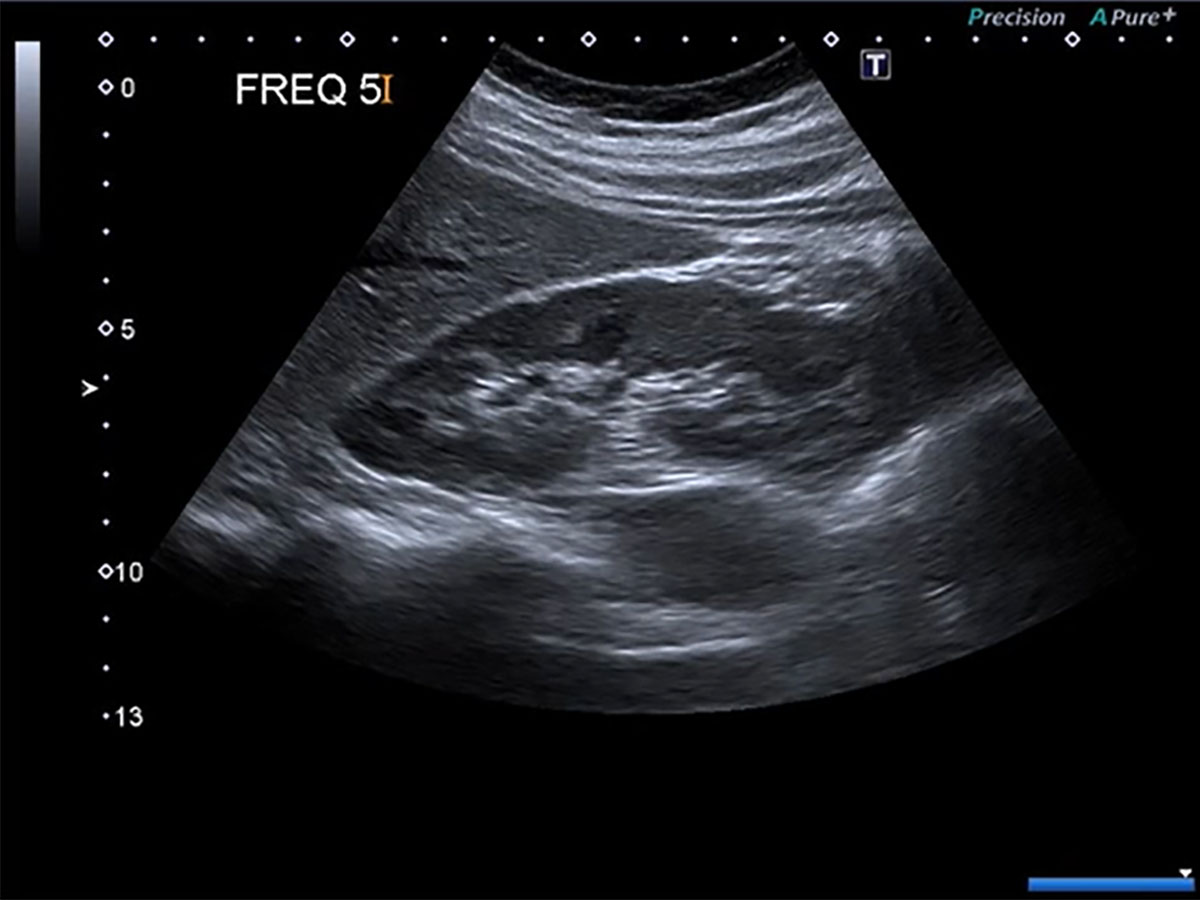 Ultrasound Physics 1 ultrasound scan