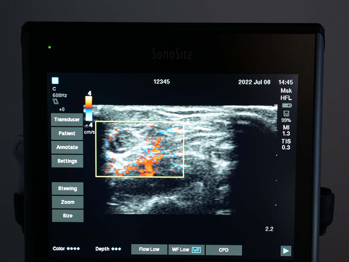 Ultrasound Physics 3 ultrasound machine